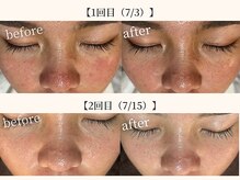 ドリームスパ 武蔵小杉店(DREAM SPA)/before→after