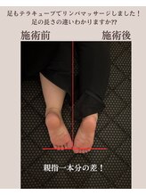 ヨサパーク ハロ(YOSA PARK Haro)/