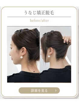 ミース 上野店/うなじケアの専門技術♪