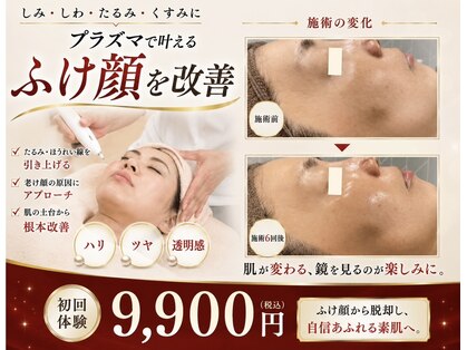 グラチア(Gratiae)の写真