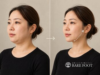 ベアフット(BARE FOOT)/顔だけじゃない
