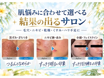 ザ リノビューティー 横浜店(THE Lino Beauty)の写真