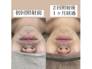 テンパ ビューティー(+10%beauty)/効果写真