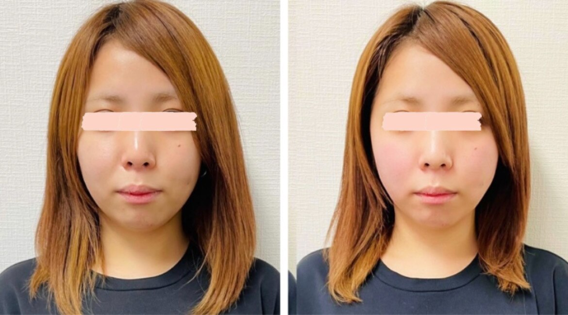 フェイスドット 梅田院(Face.)｜ホットペッパービューティー
