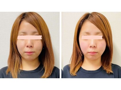 フェイスドット 梅田院(Face.)の写真