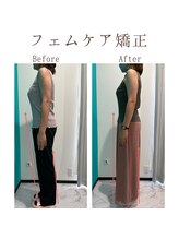 ルナ(Runa)/美容整体◆6回の効果