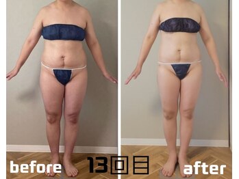 ラフォクシー(La.Foxy)/全身スリムコース