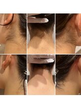 メローワックス 松本駅前店(MELLOW WAX)/後ろ姿が丸ごと綺麗に♪