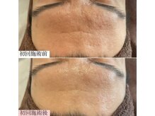 ラエッセ 恵比寿(LAESSE)/毛穴・美白専門店 LAESSE 恵比寿