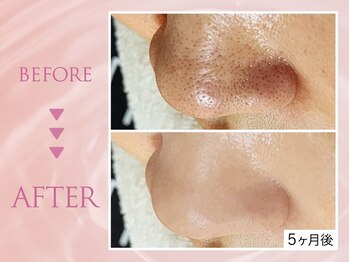 クリアラボ 池袋(Clear Lab)/韓国肌管理&毛穴洗浄専門店