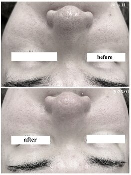 ヒルナム(Heal Nam)/プロセルセラピーズ~フェイス