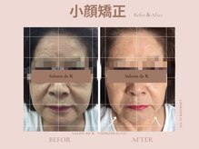カイロプラクテックサロンドアール(Salon de R)の雰囲気（７０代でもこんなに変化が♪）