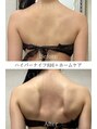 エメ(aimer) 【小顔&痩身ハイパーナイフ】マイナス4Kg Before→After◇