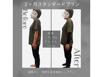 ソフィアパレス/DNAダイエットの結果ケースNo10