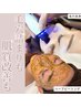 ニキビ/黒ずみ】ハーブピーリング+毛穴洗浄+ヒト幹細胞導入￥26400→￥15000