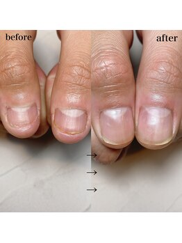 スマイルニコ(smile nico)/