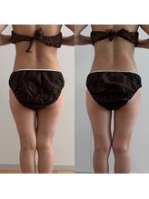 スリラ(SuriLa)/◆ビフォーアフター◆