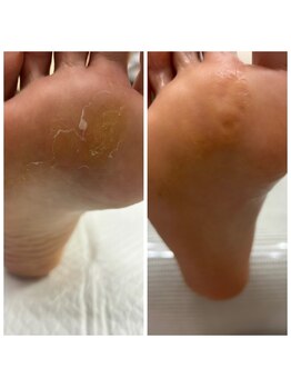 ドクターネイル爪革命 十条店/