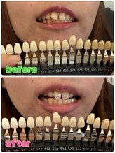 トウリンカ(tourinka)/プレミアムコース