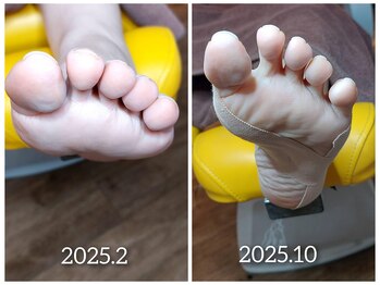 爪切り屋 足楽/【アーチサポート】