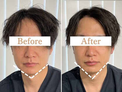 フローフシ∞の写真