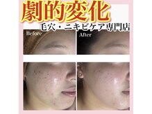 ホワイトアクア 天王寺本店(WHITE AQUA)/