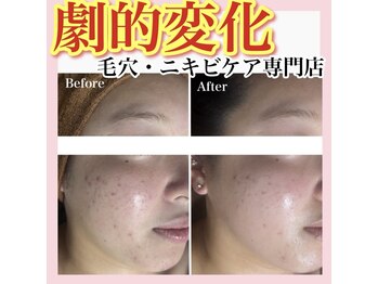 ホワイトアクア 天王寺本店(WHITE AQUA)/