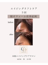 サロンドコーデ(salon de co-de)/エイジングリフトケア