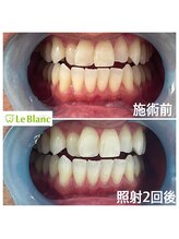 ルブラン 奈良店(Le Blanc)/美意識の高い男性のお客様