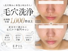 エピル(EPIL)