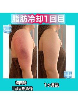 ビューティ ウィッチ(Beauty Witch)/肩周りスッキリ！！