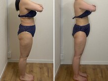 カプリス(CAPRiCE)/リンパドレナージュ