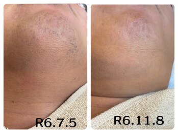 フィズ 五日市彩が丘店(FIS)/☆before/after☆都度払い