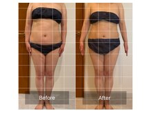 ラシェリー(La Cherie)/ビフォーアフター