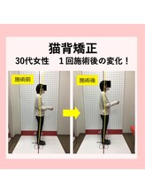 ほねつぎ長嶺鍼灸接骨院/ビフォーアフター１