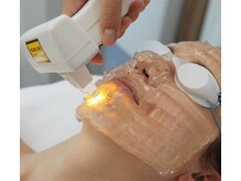 レジーナ 妙音通店(REGINA)の雰囲気（肌艶UP！肌質改善に効果的★パワーライト光フェイシャル）