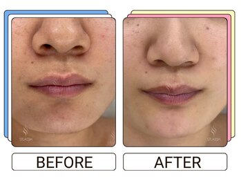 ストラッシュ 那覇アネックス店(STLASSH)/【ストラッシュ】お客様の施術例