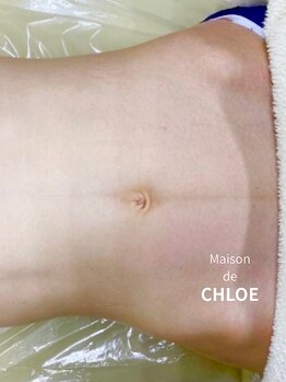メゾン ド クロエ(Maison de Chloe)の写真/『着たいドレスを“似合うドレス”に』努力は美しさに、そして本物の美しさは自信へと変わります＊