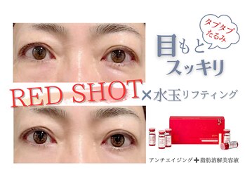 ジヒカ(ZIHICA)/【最新☆RED SHOT】目元集中ケア