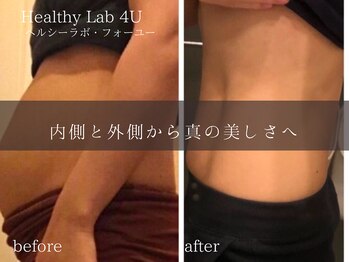 ヘルスラボフォーユー(Health Labo4U)/産後ダイエットにも