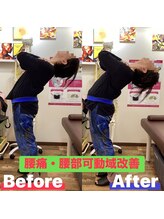 ヒデ整体院(Hide整体院)/猫背矯正骨盤矯正B/A肩こり腰痛