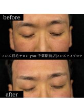 ユー 千葉駅前店(you)/ビフォ－アフター写真