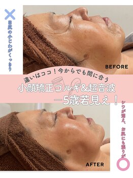 ノット(knote)/衝撃ビフォアフ6