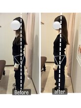 カワル整体 上通り院/骨盤の問題だけではありません。