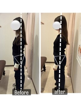 カワル整体 上通り院/骨盤の問題だけではありません。