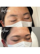 アイブロウドット 姫路(iBROW.)/美眉スタイリング☆befor⇒after