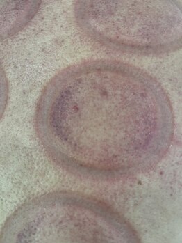 リベル(Liber)/寝不足とストレス疲れのお客様