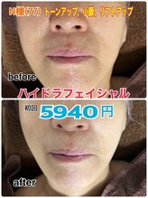 オリ(Oli)/N様お綺麗です