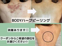 シャルムクリニカルサロン 池袋(Charme clinical salon)の雰囲気（ハーブピーリング・毛穴洗浄・ハイドラフェイシャル・ニキビケア）