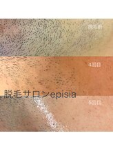 フェリーチェネイル(felice Nail)/ヒゲ脱毛